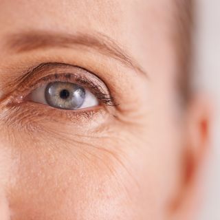 Riduzione delle Linee Sottili